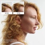 Nioxin System 4 Pro Clinical Proefpakket